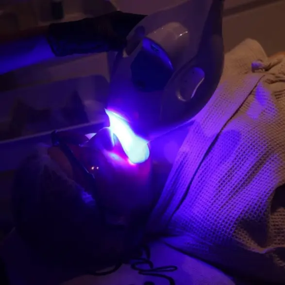 Technologie Blanchiment dentaire